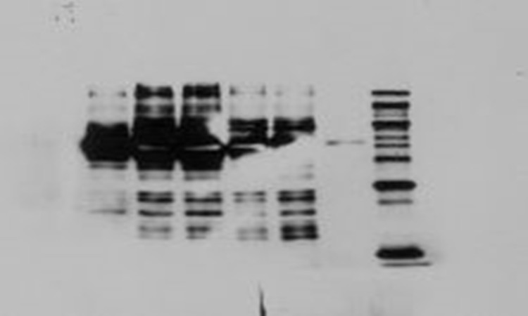 Western Blot Ҋ}